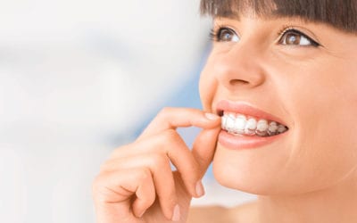 Determining If Invisalign is Right for You – Commerce Dental Office