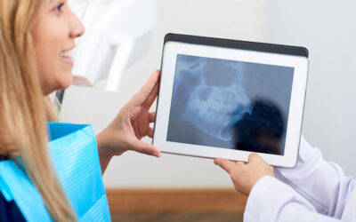 A Closer Look at the Advantages of Dental X-Rays