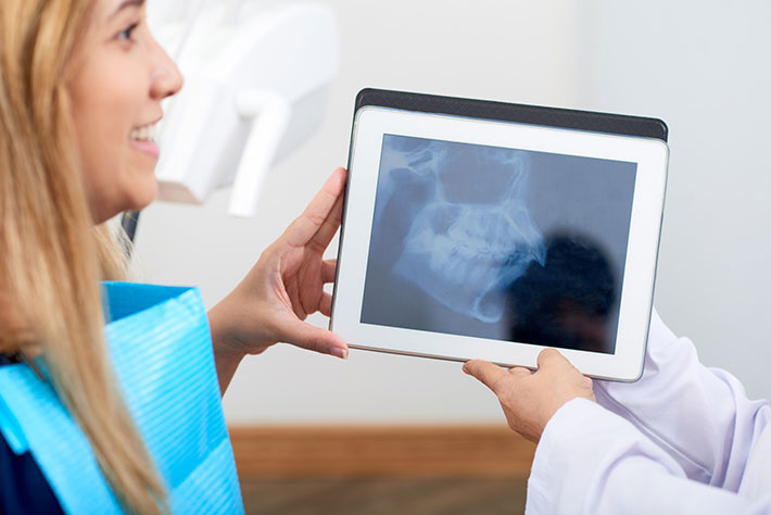 A Closer Look at the Advantages of Dental X-Rays
